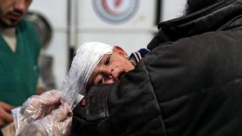 An injured nine-month-old girl receives medical attention at a field hospital in rebel-held Douma, Syria (26 November 2017)