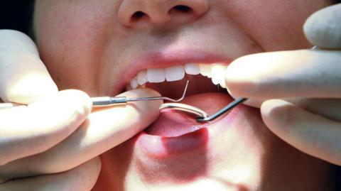 A dentist examining someone's teeth.