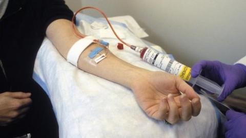 A patient receiving an intravenous dose of anticancer drugs from a syringe