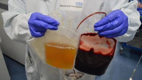 Close up shot of a blood transfusion pouch