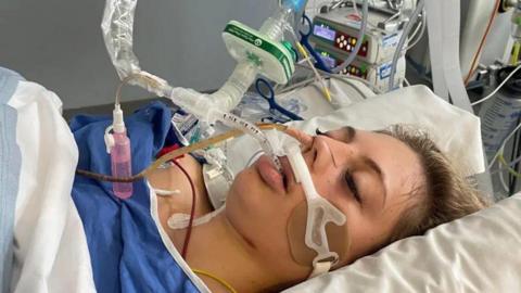 A woman lying down in a hospital bed, she is connected to medical tubes that are going into her mouth and nose