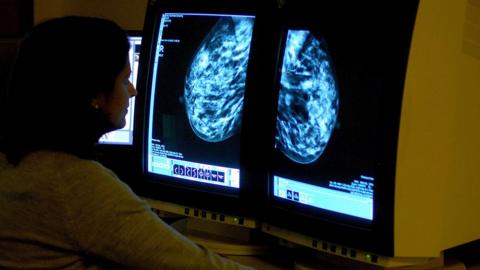 A consultant checks the image from a mammogram on two computer screens