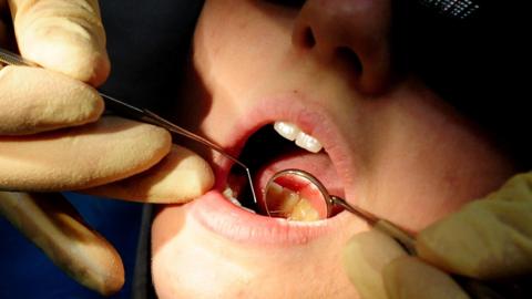 Dentist works on a patient