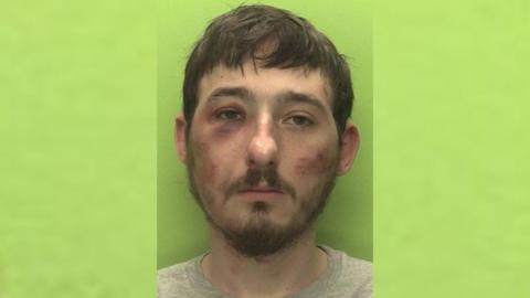 Headshot of Dean Kirby against a green background. He has a moustache and multiple scratches and bruises on his face