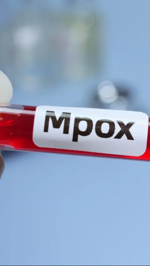 a red test tube with an Mpox label on it 