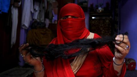 A veiled Kashmiri Muslim woman displays her braid, which was chopped off while she was unconscious