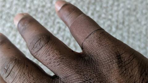 Finger with dark coloured plaster