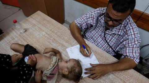 A Palestinian girl is examined by a doctor amid fears over the spread of polio in Gaza after the first case was reported by the enclave's Ministry of Health, as the war between Israel and Hamas continues, at Al-Aqsa Martyrs Hospital, in Deir Al-Balah in the central Gaza Strip, August 18, 2024