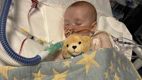 Baby asleep in hospital bed surrounded by tubes and wires - and a teddy bear