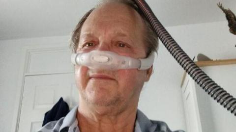 Trevor Entwistle pictured wearing a nasal mask connected to a machine. He has a balding head with grey hair down the side and is stood in a room looking at the camera