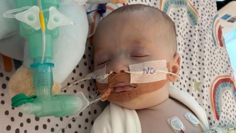 A baby is seen with various tubes and medical equipment attached to him. He is laid on a bed with a white and black dotted pattern and colourful semi circles. 