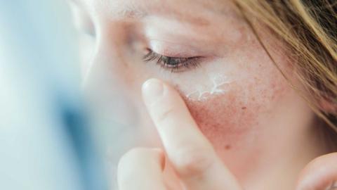 Close up of woman adding creme to a sore looking cheek