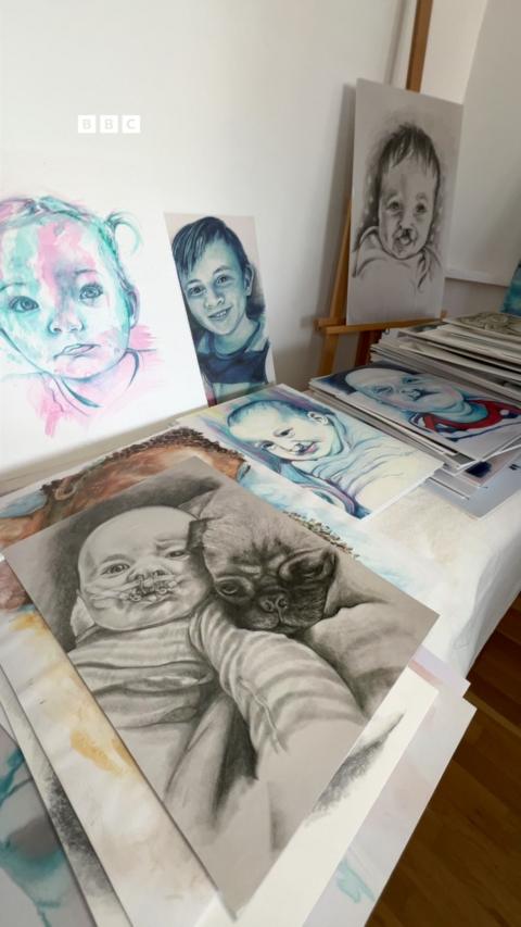 Art depicting children born with cleft palate.