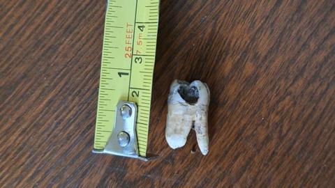 A tooth next to a yellow tape measure. It measures at about 2.5cm and is on a dark wooden table.