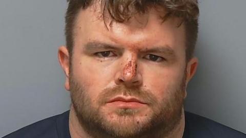 A mugshot of Watts. He has brown hair and a brown beard. He has blood on his nose.