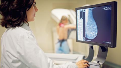 A doctor checks a mammogram breast scan on a computer screen for any early signs of cancer