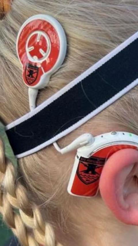 The side of a girls face with a cochlear implant with AFC Portchester on it.