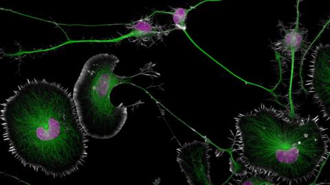 Mouse brain tumour cells