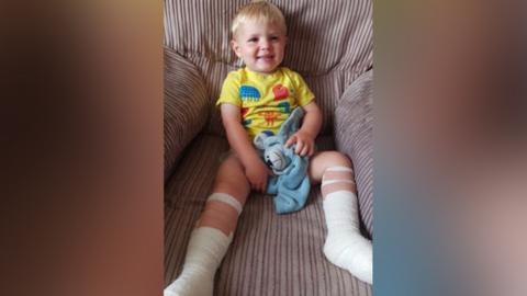 Harri with dressings on his feet and lower legs.