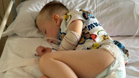 Young boy lies in a hospital bed wearing white shirt with cartoon faces and a nappy. A tube is coming out of his bandaged elbow.