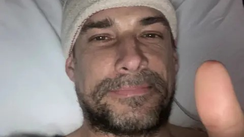 A man with stubble and a smile lies in a hospital bed with a bandage round his head and a thumbs up.