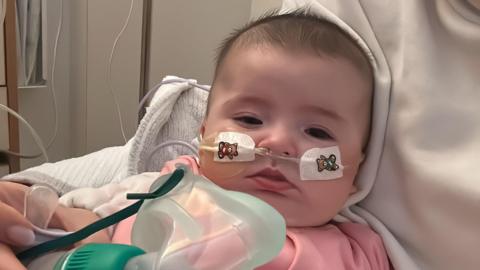 A baby in hospital with tubes coming out of her nose, she has breathing equipment in front of her. The baby is wearing a pink top.