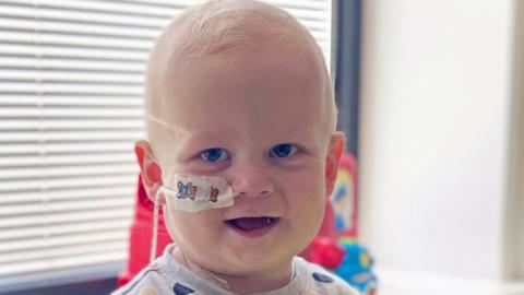 Corey in hospital with a nasogastric tube in his nose, smiling