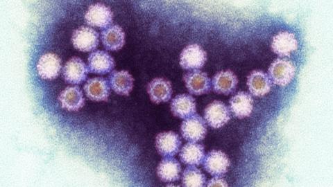 Norovirus