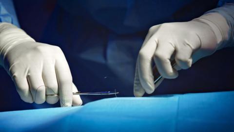 Surgeon's hands during operation