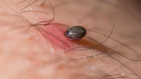 A tick biting a human arm