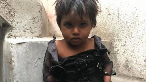 Two-year old Safiya who was found in Delhi's Shiv Vihar