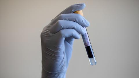 A hand in a blue glove holds a test tube containing a blood sample. It is set against a light coloured background.