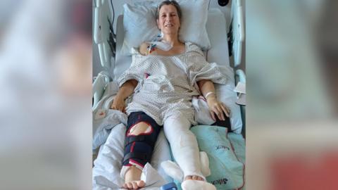 Janet Crook-Moore in a hospital bed with casts around her legs.