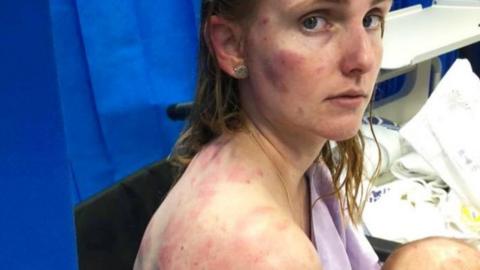 Fiona Simpson is seen with bruises and cuts on her face and body