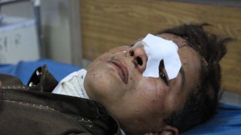 An Afghani kid receives medical treatment after US airstrikes struck IS positions in Nangarhar Province, Afghanistan on July 2, 2018.