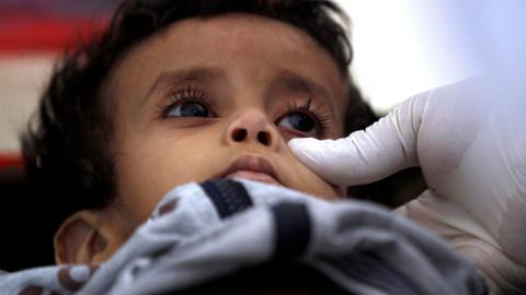 A Yemeni child suspected of being infected with cholera receives treatment at a makeshift hospital in Sanaa on 5 June 2017