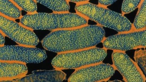 A close up of the legionella bacteria