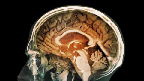 Brain