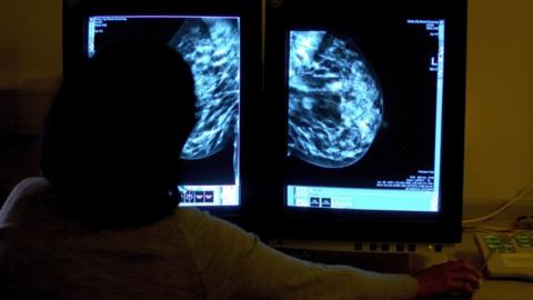 Silhouette of a consultant looking at a screen showing a mammogram.