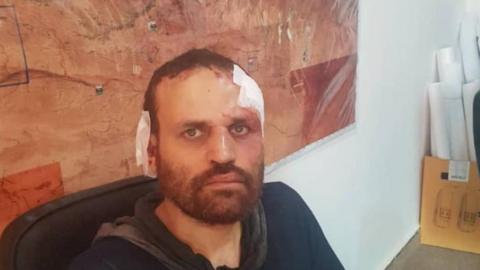 Hisham al-Ashmawy after being captured