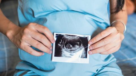 woman with a scan of her baby