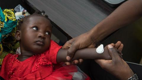 A young Gambian child with a microarray patch applied to the wrist