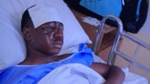 Tega Agberhiere was injured in the attack