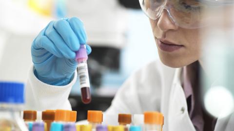 Tubes of blood samples and a scientist in a laboratory