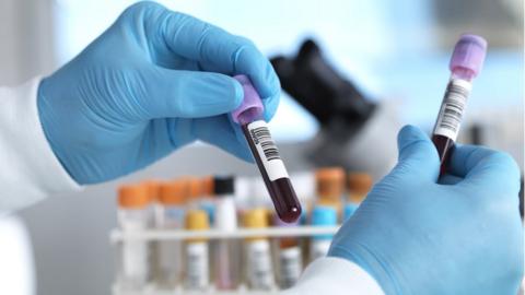 Hand holding blood sample in laboratory