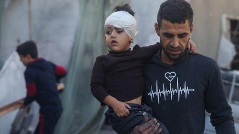 A Palestinian man carries a child injured during Israeli bombardment in Rafah, on the southern Gaza Strip, on 2 December 2023