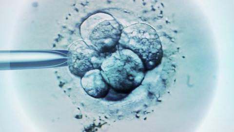 Embryo selection for IVF