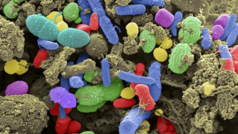 Close-up of various bacteria found in a sample of human faeces. Many of these bacteria are a normal part of the flora found in the intestines and are beneficial to digestion.