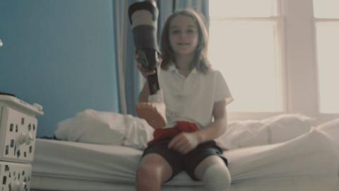 Euan with his prosthetic leg