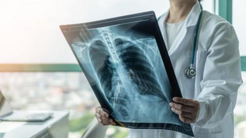 Medic examining chest x-ray